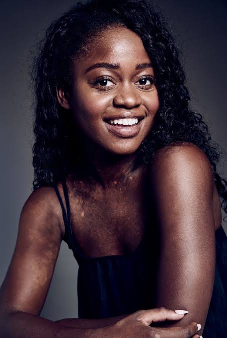 Ballerina Michaela DePrince Passes Away at 29