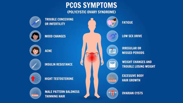 Understanding PCOS Among Young Girls